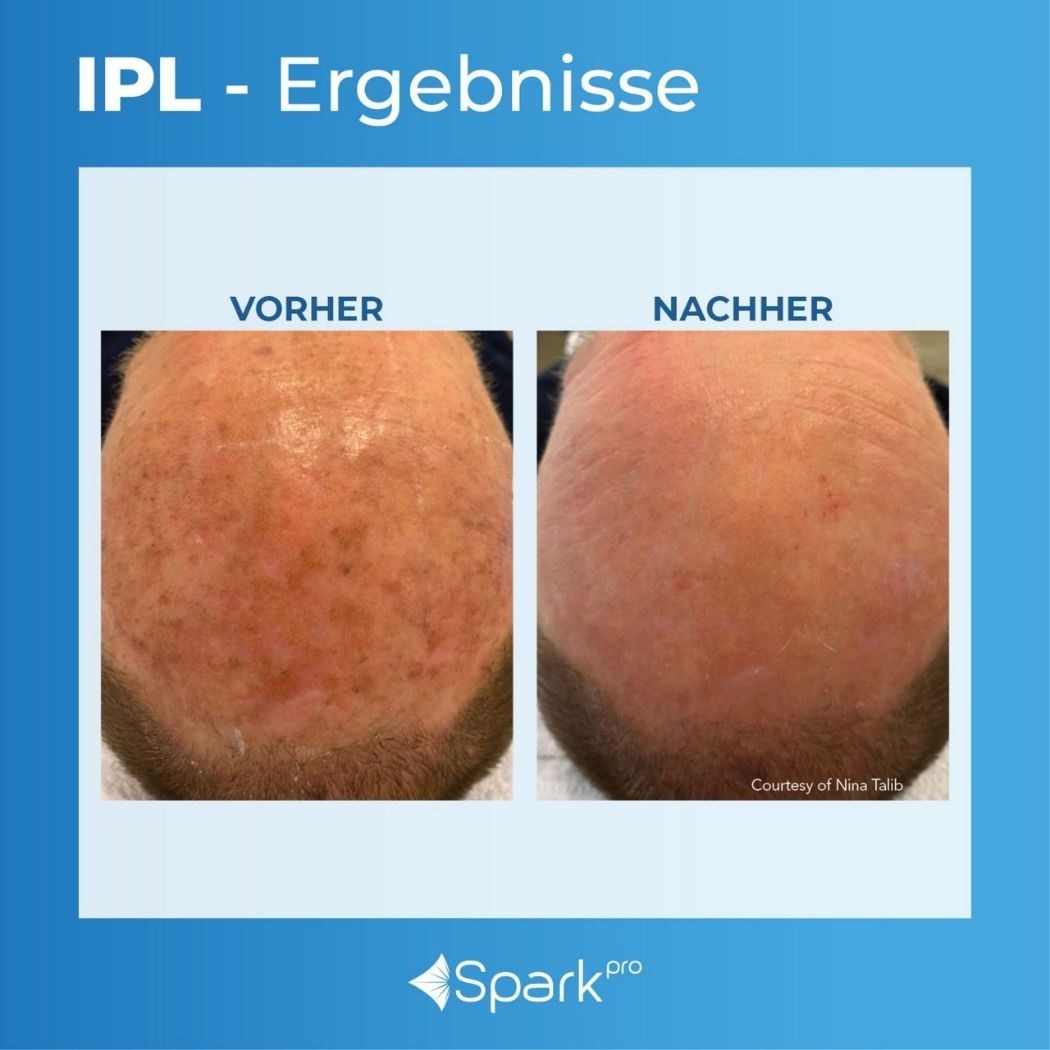 ERGEBNISSE – Bevnique Beauty