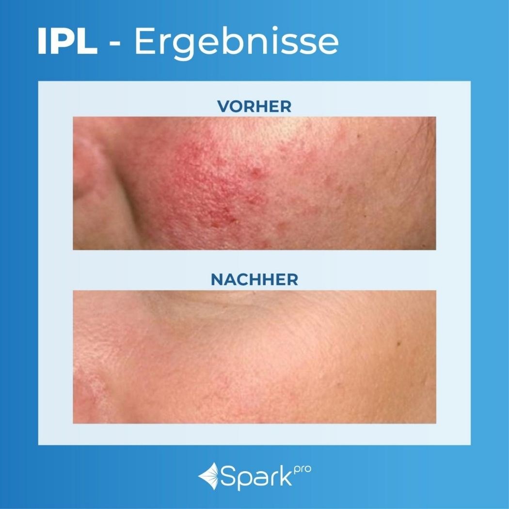 ERGEBNISSE – Bevnique Beauty