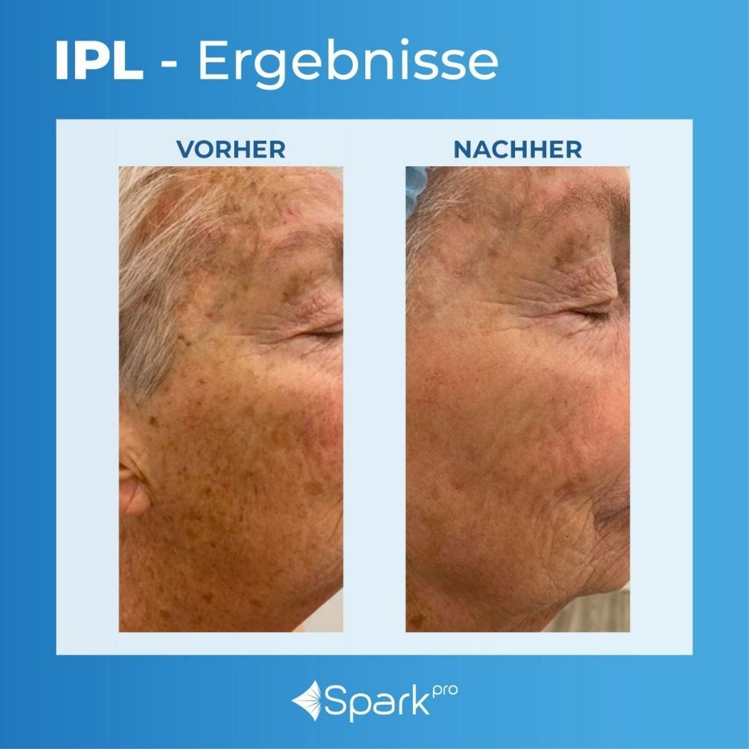ERGEBNISSE – Bevnique Beauty