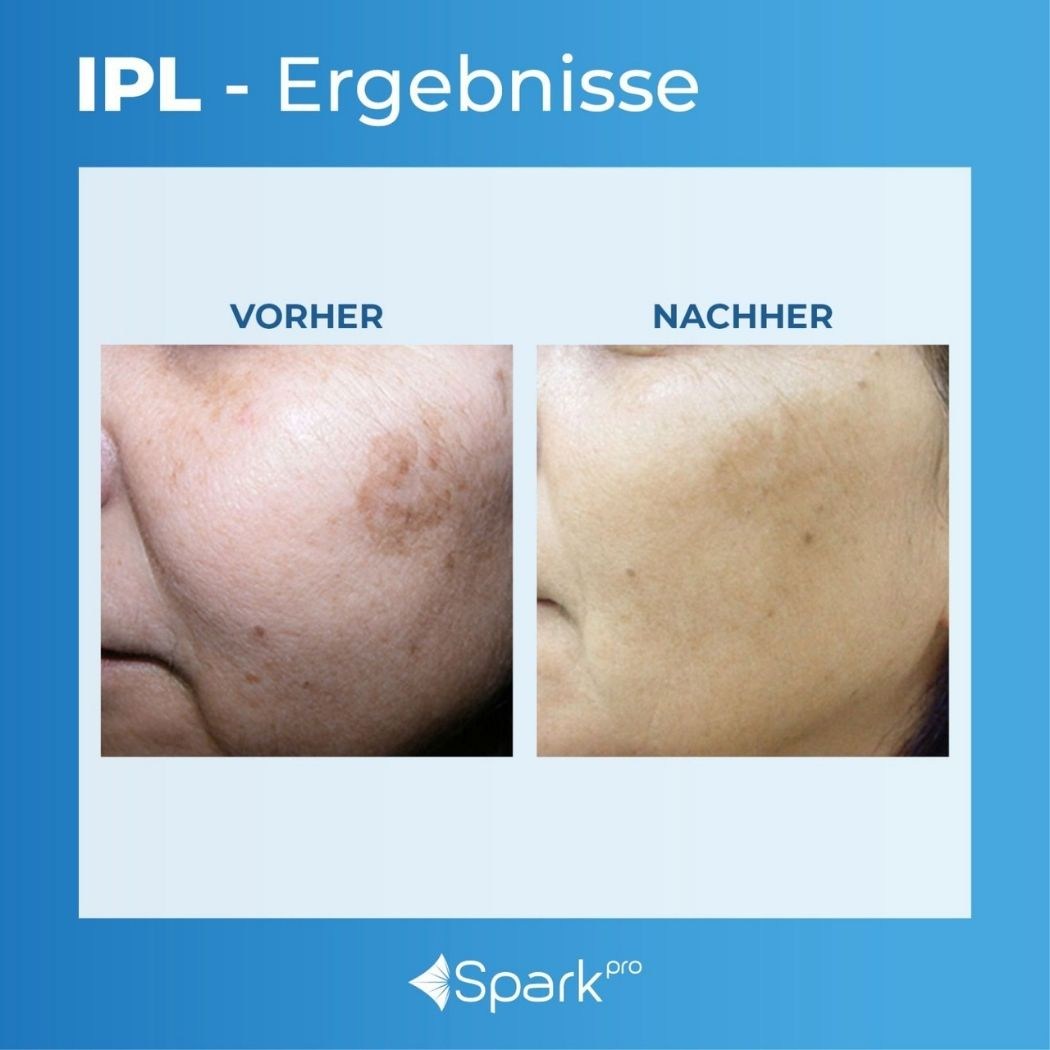 ERGEBNISSE – Bevnique Beauty