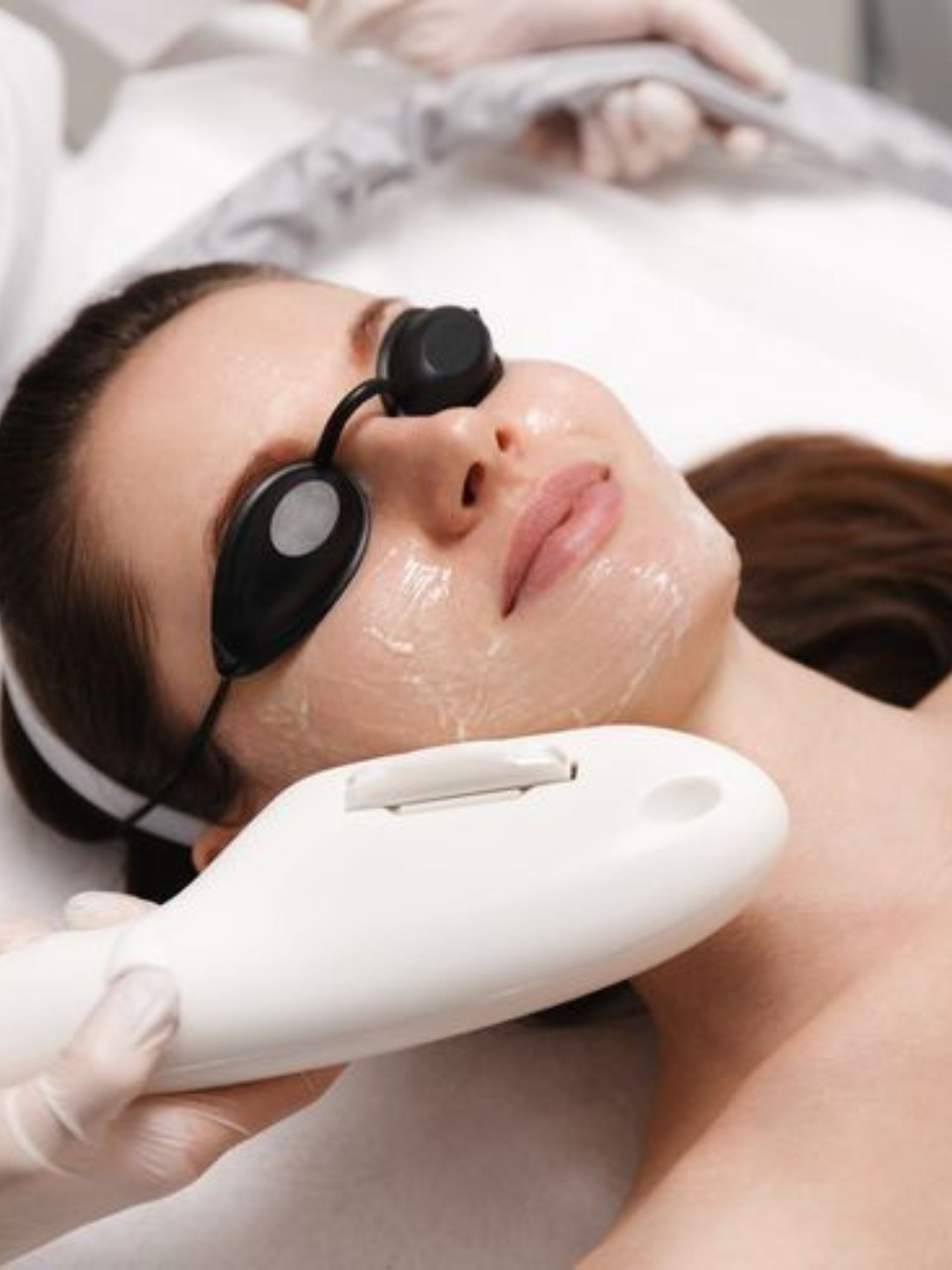 IPL-Hautverjüngerung bei Bevnique Beauty
